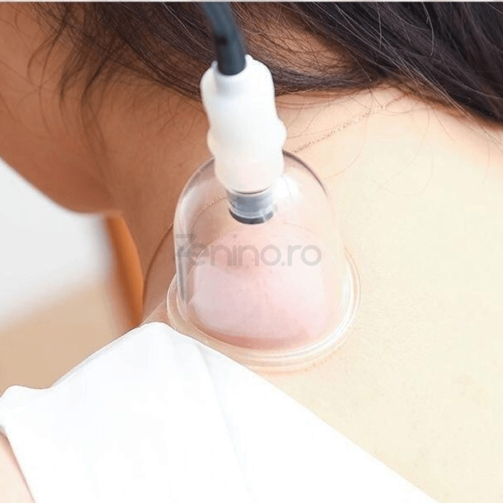 Set of 12 Massage Cups, Electric Vacuum Device, Anti-Cellulite, Batteries, Micro USB Charging, Therapy, Relaxation, White