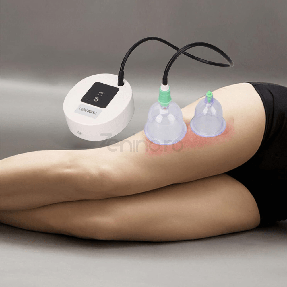 Set of 12 Massage Cups, Electric Vacuum Device, Anti-Cellulite, Batteries, Micro USB Charging, Therapy, Relaxation, White