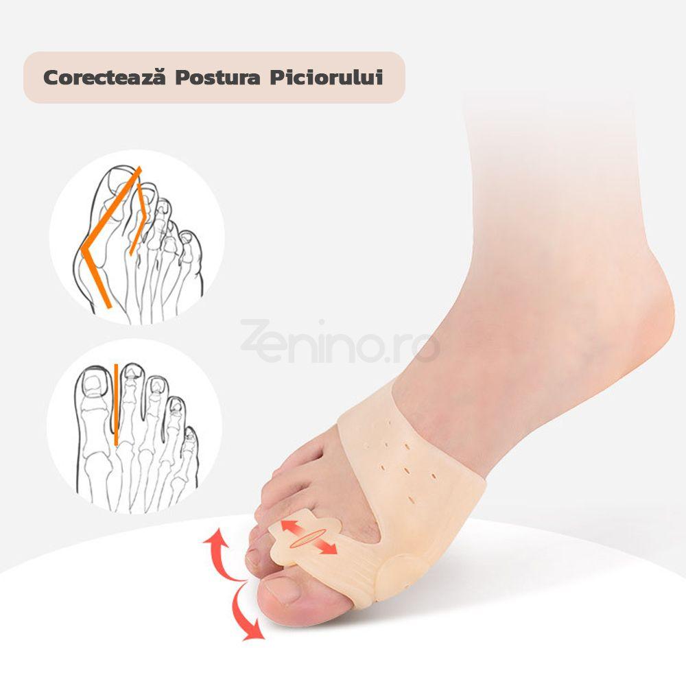 Set of 2 Finger Correctors, Reduces Inflammation, Suitable for Mounts, Universal Size, Silicone, Skin Color