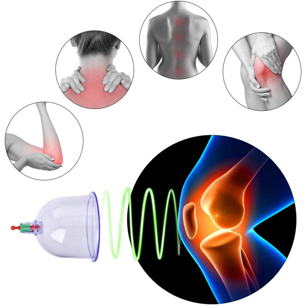 Set of 12 Massage Cupping Cups, Vacuum Pump, Anti-Cellulite, Therapy, Relaxation, White