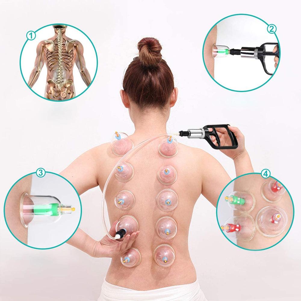 Set of 12 Massage Cupping Cups, Vacuum Pump, Anti-Cellulite, Therapy, Relaxation, White