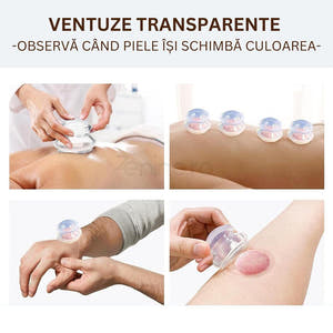 Set of 4 Massage Cupping Cups, Therapeutic, Anti-Cellulite, Relaxation, Soft Silicone, Transparent/Blue