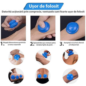 Set of 4 Massage Cupping Cups, Therapeutic, Anti-Cellulite, Relaxation, Soft Silicone, Transparent/Blue