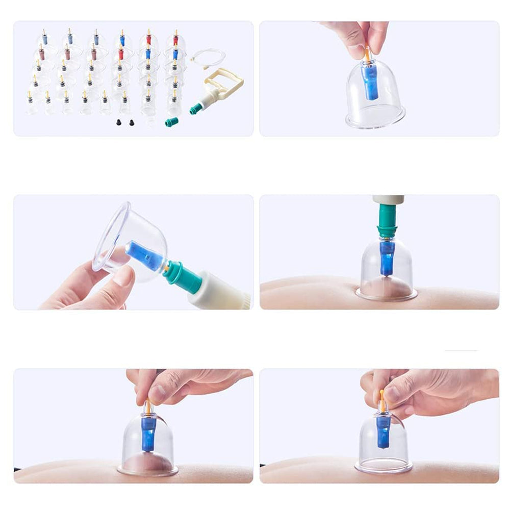 Set 12 Ventuze de Masaj Zenino® - Pompa Vacuum, Anticelulita, Terapie, Relaxare, Alb
